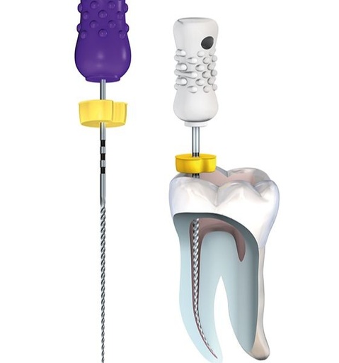 [KO6409] LIMAS PATENSY 17525.654.010 P/SONDEO 6 UD