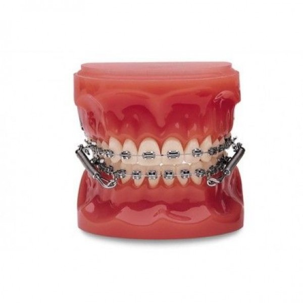 SPLIT CRIMP UNIVERSAL 50ud.