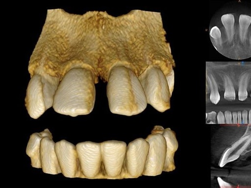 [CR0014] PANORAMICO CS 8100 3D