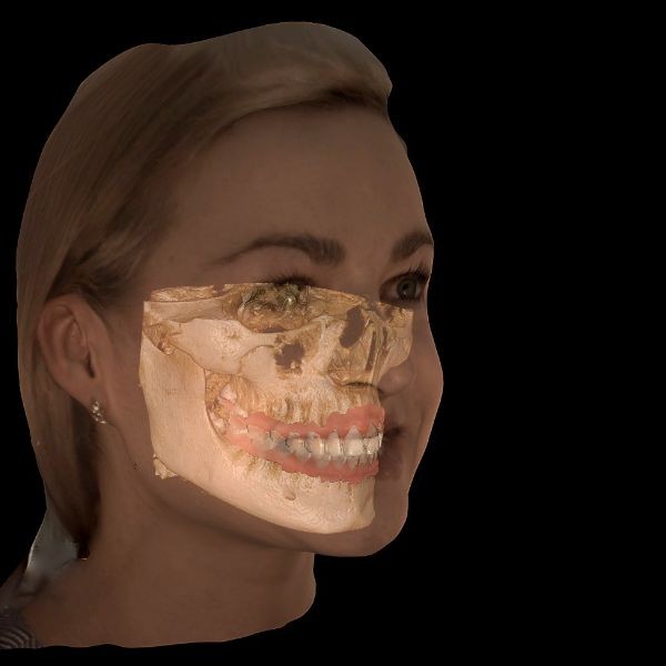 CS Face Scan kit** para CS 9600