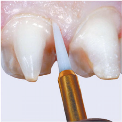 [ED0098] FRESA CERAMICA FG CIRUGIA ESTT250 1ud.