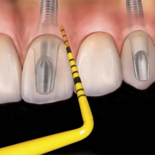 [HF1236] PCVUNC12PT SONDA PERIO HU FRIEDY