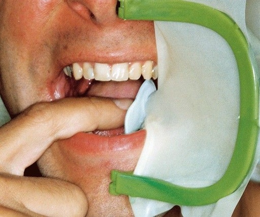 [HK0757] ARCO H&W PLÁSTICO ARTICULADO