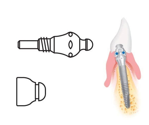 [KO5781] MICROPLANT KOMET 4305A.0 KIT ANCLAJE ANILLO