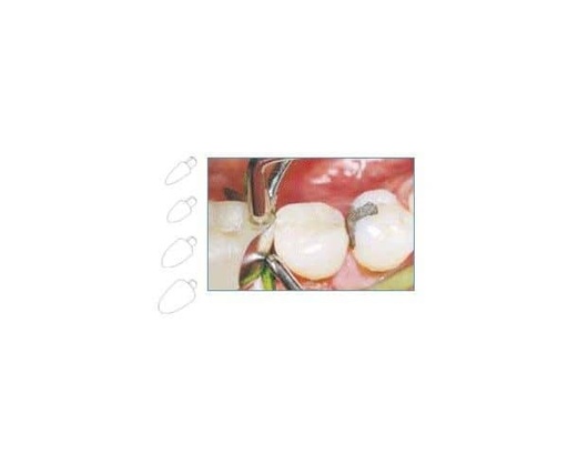 [LM7543] 7624 REFILL PEQUEÑOS FORMADOR 60 UNID.11751