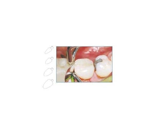 [LM7567] 7620 FORMADORES DE CONTACTO LM surtido 120 ud