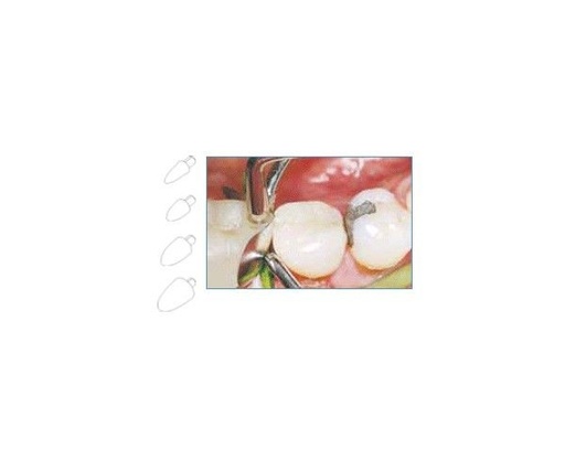 [LM7636] 7622 FORMADORES DE CONTACTO LM extra pequeños 60ud